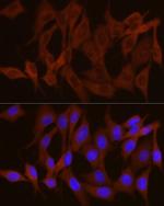 GPBB Antibody in Immunocytochemistry (ICC/IF)