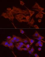 GPBB Antibody in Immunocytochemistry (ICC/IF)