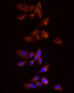 GPBB Antibody in Immunocytochemistry (ICC/IF)