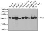 GPBB Antibody in Western Blot (WB)