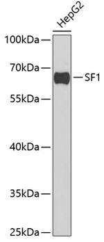 SF1 Antibody in Western Blot (WB)