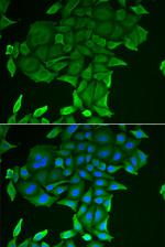 CD84 Antibody in Immunocytochemistry (ICC/IF)