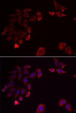 SKAP2 Antibody in Immunocytochemistry (ICC/IF)