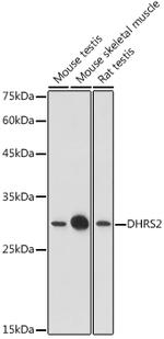 DHRS2 Antibody in Western Blot (WB)