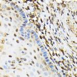 NRBF2 Antibody in Immunohistochemistry (Paraffin) (IHC (P))