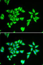 Bit1 Antibody in Immunocytochemistry (ICC/IF)