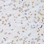 Bit1 Antibody in Immunohistochemistry (Paraffin) (IHC (P))