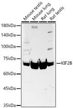 KIF2B Antibody in Western Blot (WB)