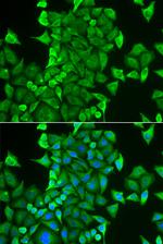 CARS Antibody in Immunocytochemistry (ICC/IF)