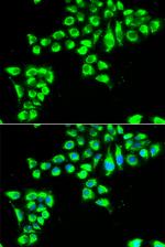 Claudin 2 Antibody in Immunocytochemistry (ICC/IF)