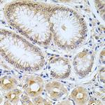 Carboxypeptidase M Antibody in Immunohistochemistry (Paraffin) (IHC (P))