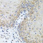 Carboxypeptidase M Antibody in Immunohistochemistry (Paraffin) (IHC (P))