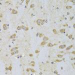 EEF1B2 Antibody in Immunohistochemistry (Paraffin) (IHC (P))