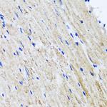 HYAL1 Antibody in Immunohistochemistry (Paraffin) (IHC (P))