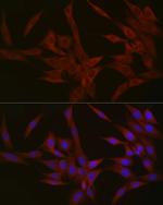 NPHP1 Antibody in Immunocytochemistry (ICC/IF)