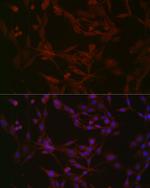 NPHP1 Antibody in Immunocytochemistry (ICC/IF)