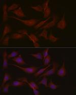 NPHP1 Antibody in Immunocytochemistry (ICC/IF)