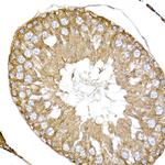 NPHP1 Antibody in Immunohistochemistry (Paraffin) (IHC (P))