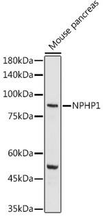 NPHP1 Antibody in Western Blot (WB)