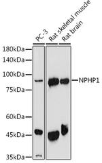 NPHP1 Antibody in Western Blot (WB)