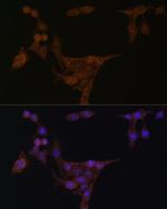 PPAT Antibody in Immunocytochemistry (ICC/IF)