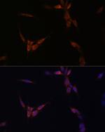 PP2A alpha Antibody in Immunocytochemistry (ICC/IF)