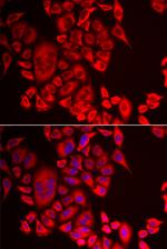 QPCT Antibody in Immunocytochemistry (ICC/IF)