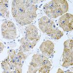 RAPSN Antibody in Immunohistochemistry (Paraffin) (IHC (P))