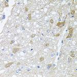 RAPSN Antibody in Immunohistochemistry (Paraffin) (IHC (P))