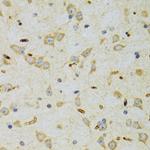 SRP19 Antibody in Immunohistochemistry (Paraffin) (IHC (P))