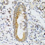 SRP19 Antibody in Immunohistochemistry (Paraffin) (IHC (P))