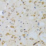 SRP19 Antibody in Immunohistochemistry (Paraffin) (IHC (P))