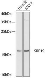 SRP19 Antibody in Western Blot (WB)