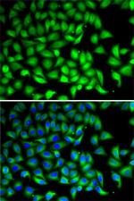 SUFU Antibody in Immunocytochemistry (ICC/IF)