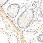 TAGLN Antibody in Immunohistochemistry (Paraffin) (IHC (P))