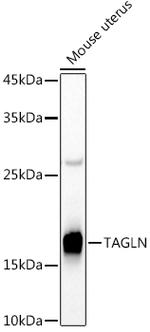 TAGLN Antibody in Western Blot (WB)