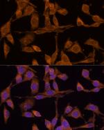 USP15 Antibody in Immunocytochemistry (ICC/IF)