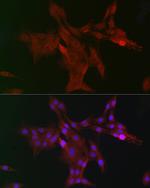 DCAF7 Antibody in Immunocytochemistry (ICC/IF)