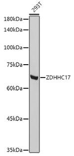 ZDHHC17 Antibody in Western Blot (WB)