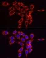 ACSL4 Antibody in Immunocytochemistry (ICC/IF)