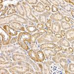 ACSL4 Antibody in Immunohistochemistry (Paraffin) (IHC (P))