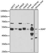 XIAP Antibody in Western Blot (WB)