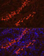 ATP6V1B1 Antibody in Immunohistochemistry (Paraffin) (IHC (P))