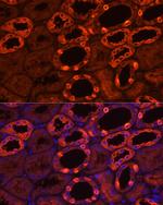 ATP6V1B1 Antibody in Immunohistochemistry (Paraffin) (IHC (P))