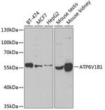 ATP6V1B1 Antibody in Western Blot (WB)