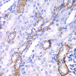 MYO1C Antibody in Immunohistochemistry (Paraffin) (IHC (P))