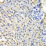 SNRPD2 Antibody in Immunohistochemistry (Paraffin) (IHC (P))