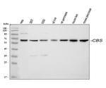 CBS Antibody in Western Blot (WB)