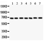 GAD67 Antibody in Western Blot (WB)