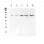 CHK2 Antibody in Western Blot (WB)